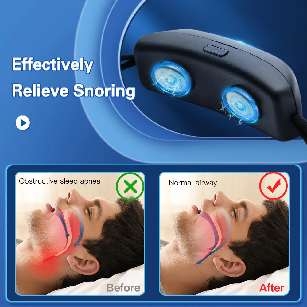EMS Smart Anti-Snoring Device