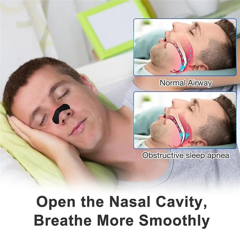 M12K-Nasal Strips