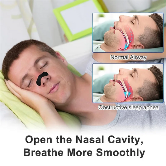 M12K-Nasal Strips