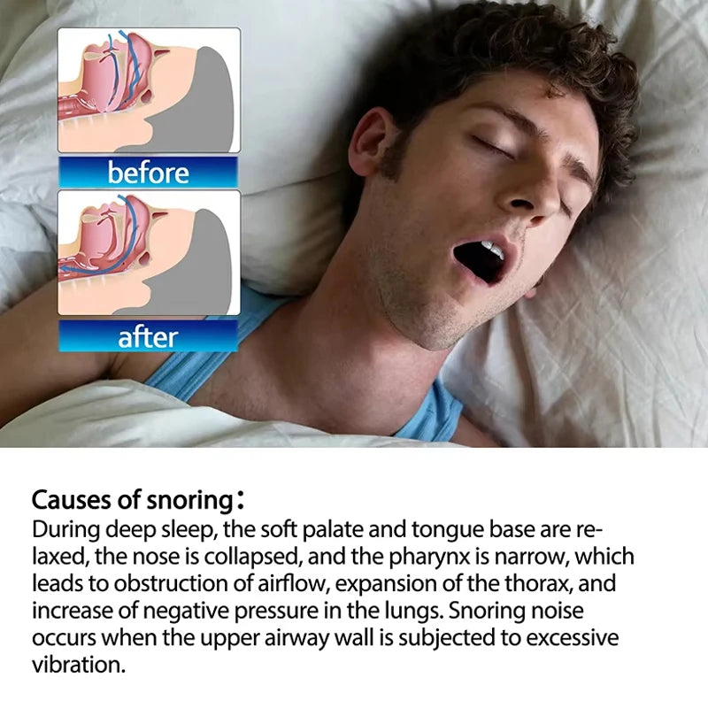 30pcs Mouth Tape For Sleep Apnea