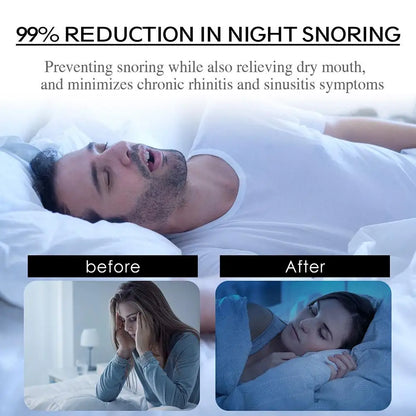 Anti-Snoring Patch Nose Breathing Correction