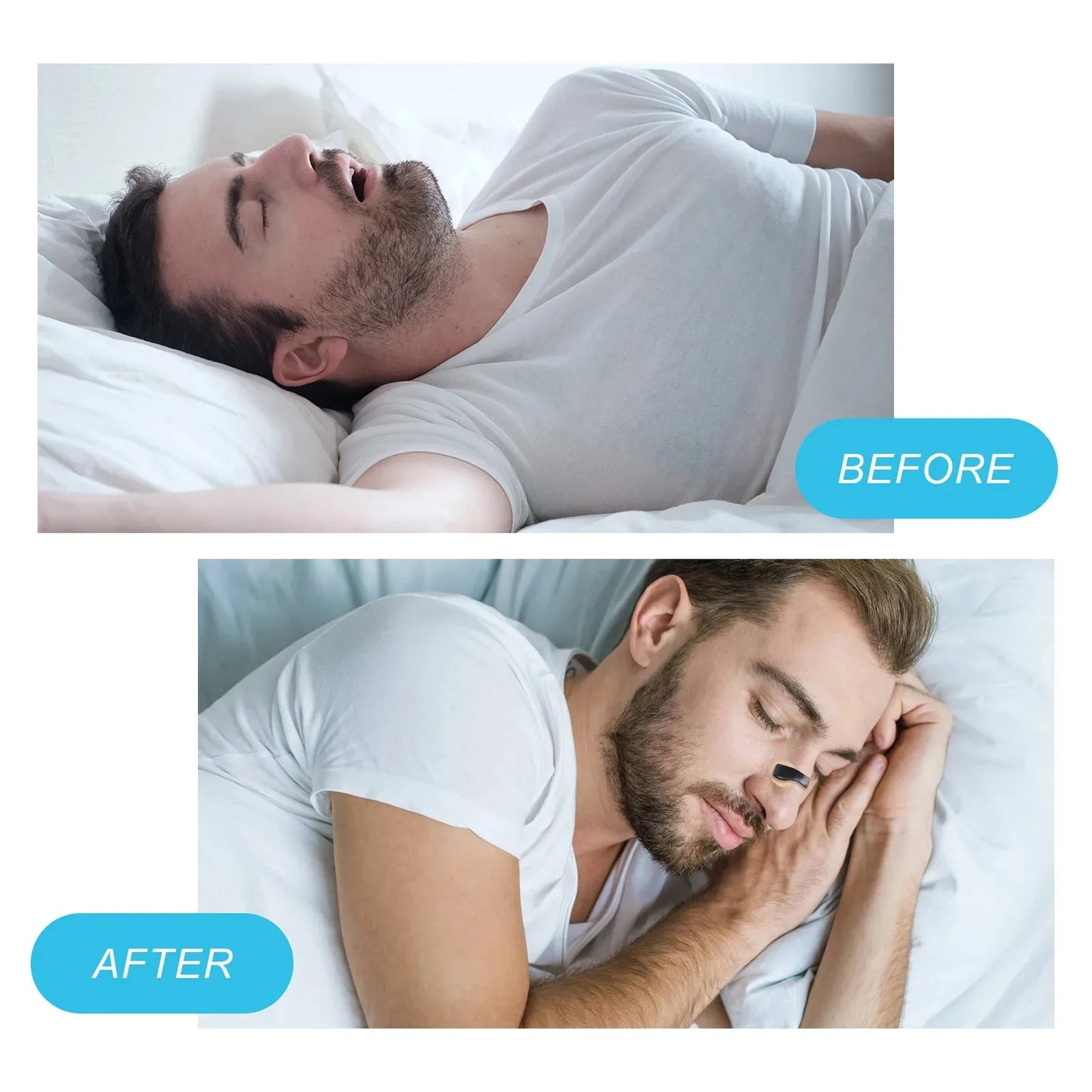 Nasal Breathing Dilators Starter Kit