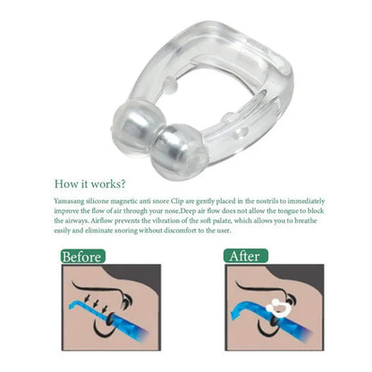Hot Anti Snoring Corrector