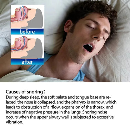 30pcs Mouth Tape For Sleep Apnea