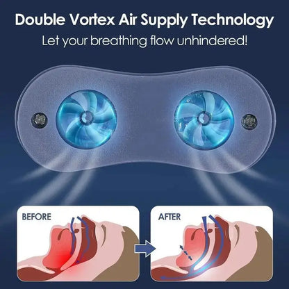 Electric Anti Snoring Devices
