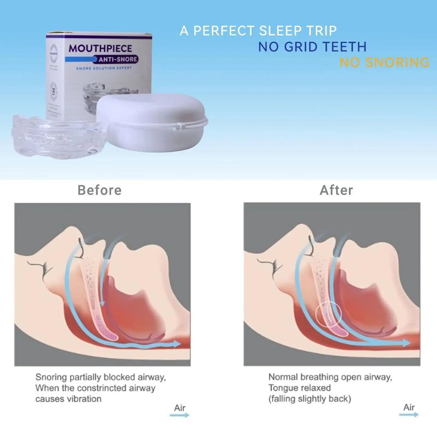Adjustable Anti-Snoring Mouth Guard