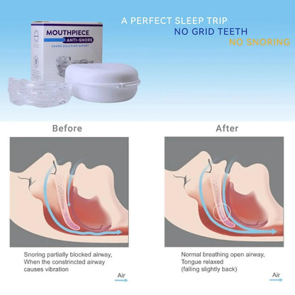 Adjustable Anti-Snoring Mouth Guard